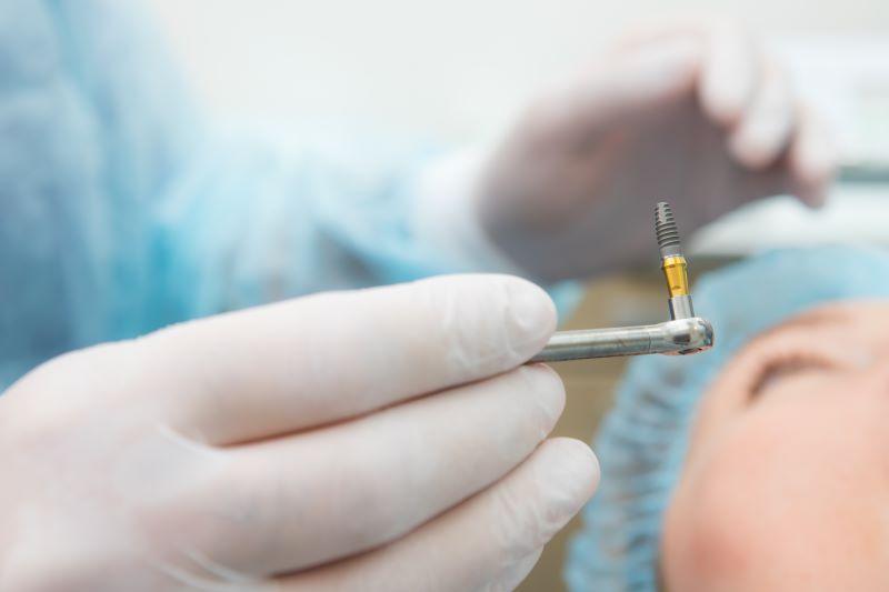 Dentist holding dental implant during surgery