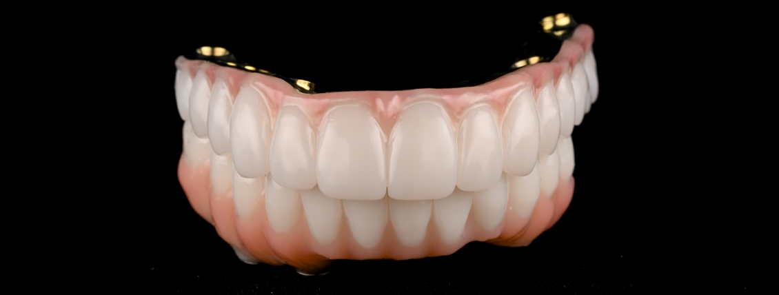 Implant denture displayed against dark background