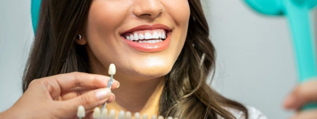 Smiling woman beside a tooth shade guide held by a dental professional