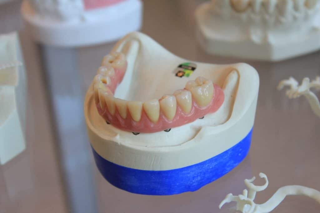 Temporary Crown Care: Essential Dos and Don'ts While You Wait | Boston Prosthodontist - Temporary Crown Care: Dos and Don'...