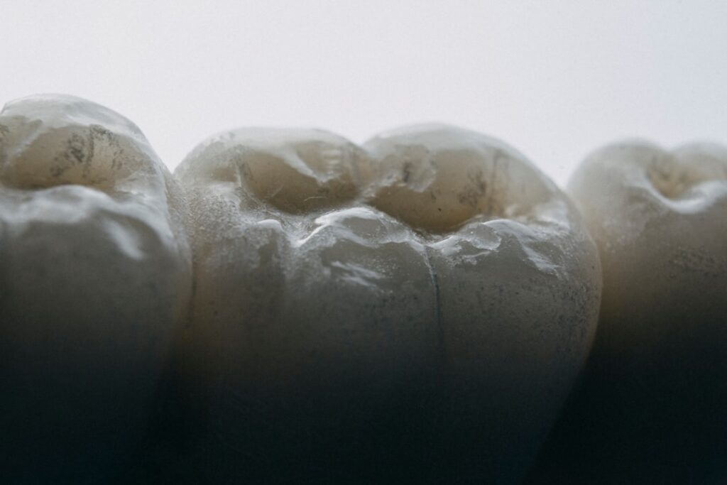 How Long Does a Dental Crown Last? Expert Guide to Crown Lifespan and Care - How Long Does a Dental Crown Last? Lifespan a...